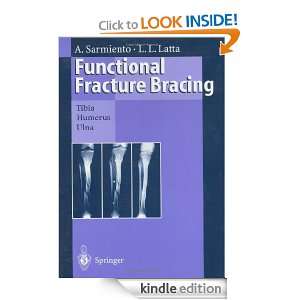 Functional Fracture Bracing Tibia, Humerus and Ulna [Kindle Edition]
