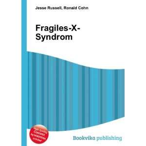  Fragiles X Syndrom Ronald Cohn Jesse Russell Books