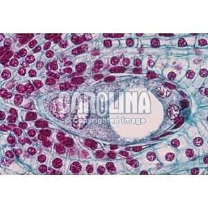 Lily Ovulary, Third Mitotic Division after Fusion of 3 Haploid Nuclei 