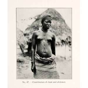  1930 Print Woman Nudity Cicatrization Chest Abdomen 