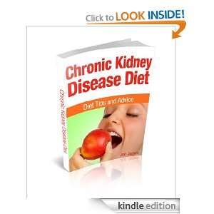 Chronic Kidney Disease Diet   Diet Tips and Advice Jon James  